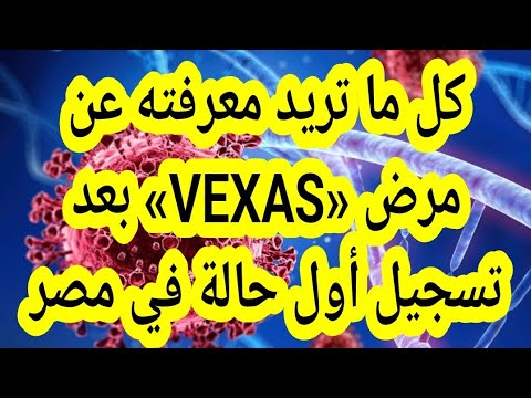 مرض فيكساس